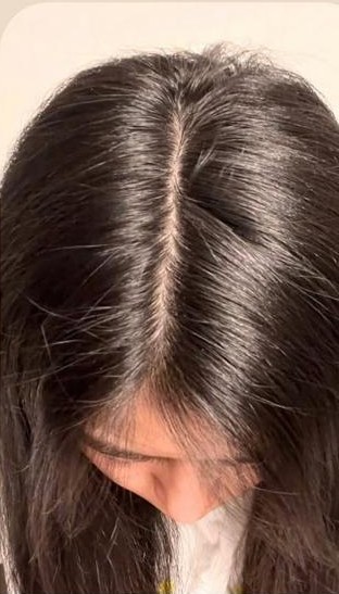 Hair after