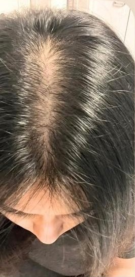 Hair before